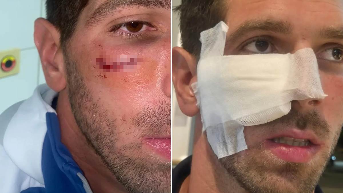  Dominik Kovačić povrijeđen na meču Rijeke i Slaven Belupa 