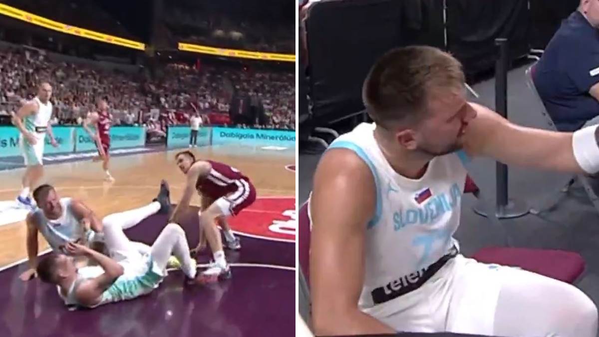  Luka Dončić se povrijedio pred Eurobasket  