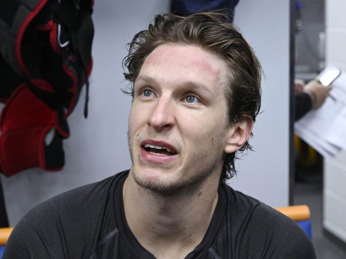  Nhl sampion se opekao na rostilju 