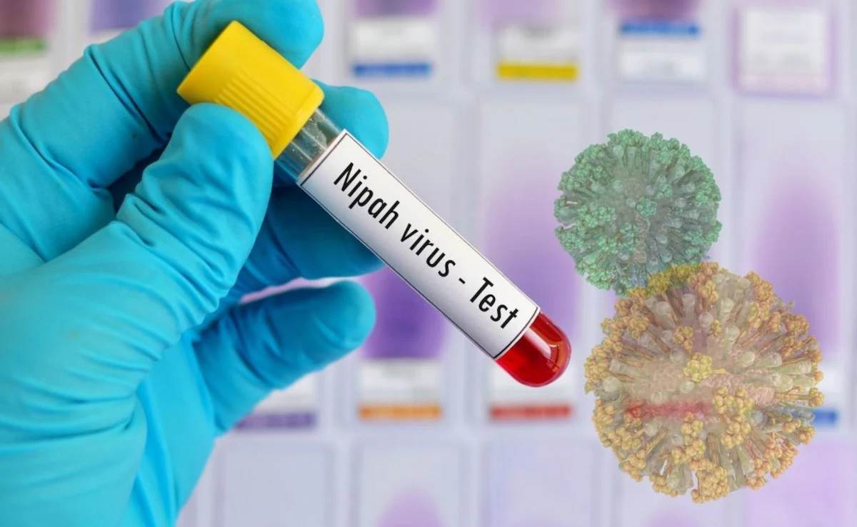  U Srpskoj nema regostrovanih slučajeva virusa Nipah 