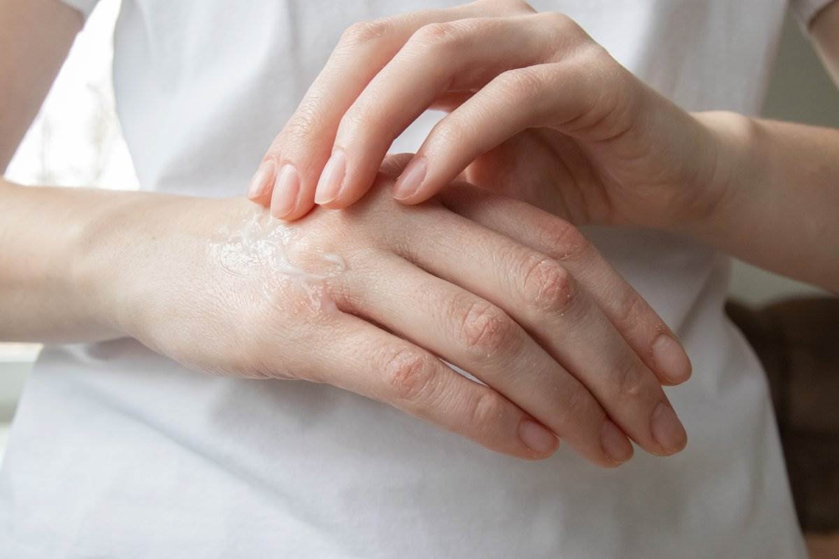  Kako oporaviti suve i ispucale ruke 