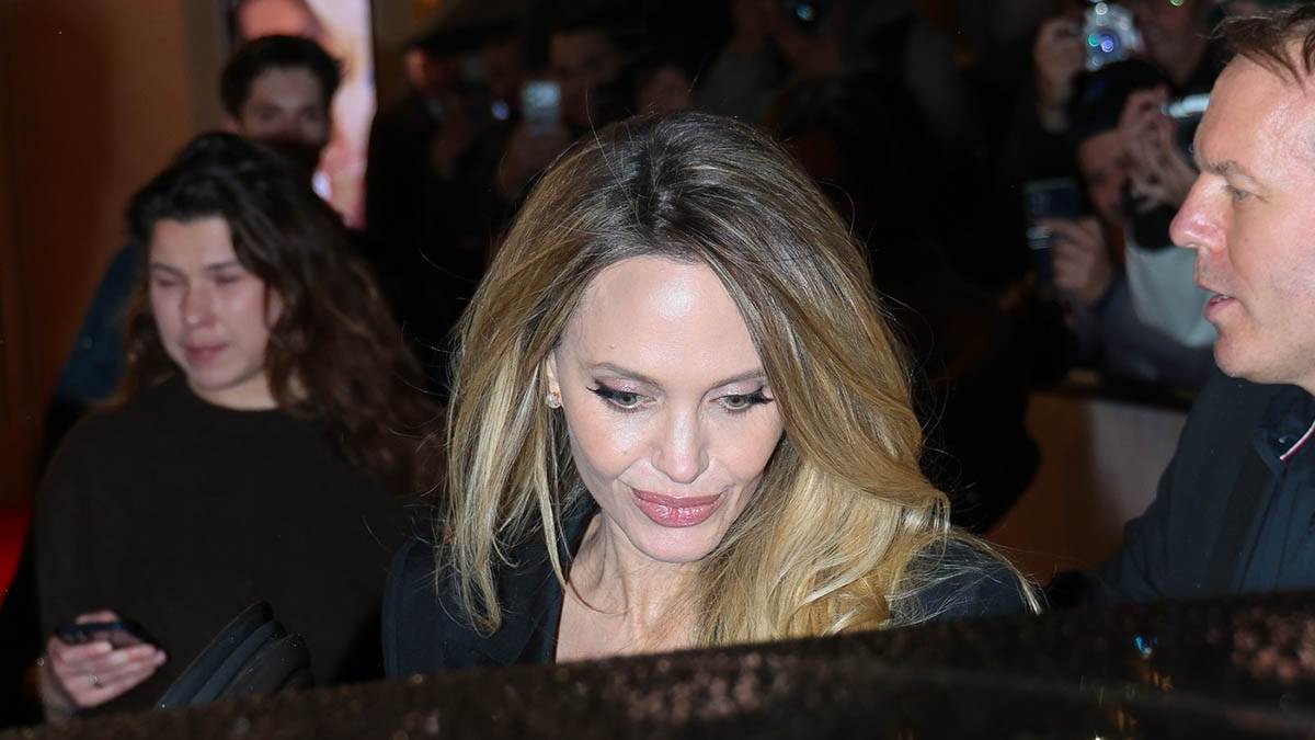  Šta je sve na licu operisala anđelina džoli 