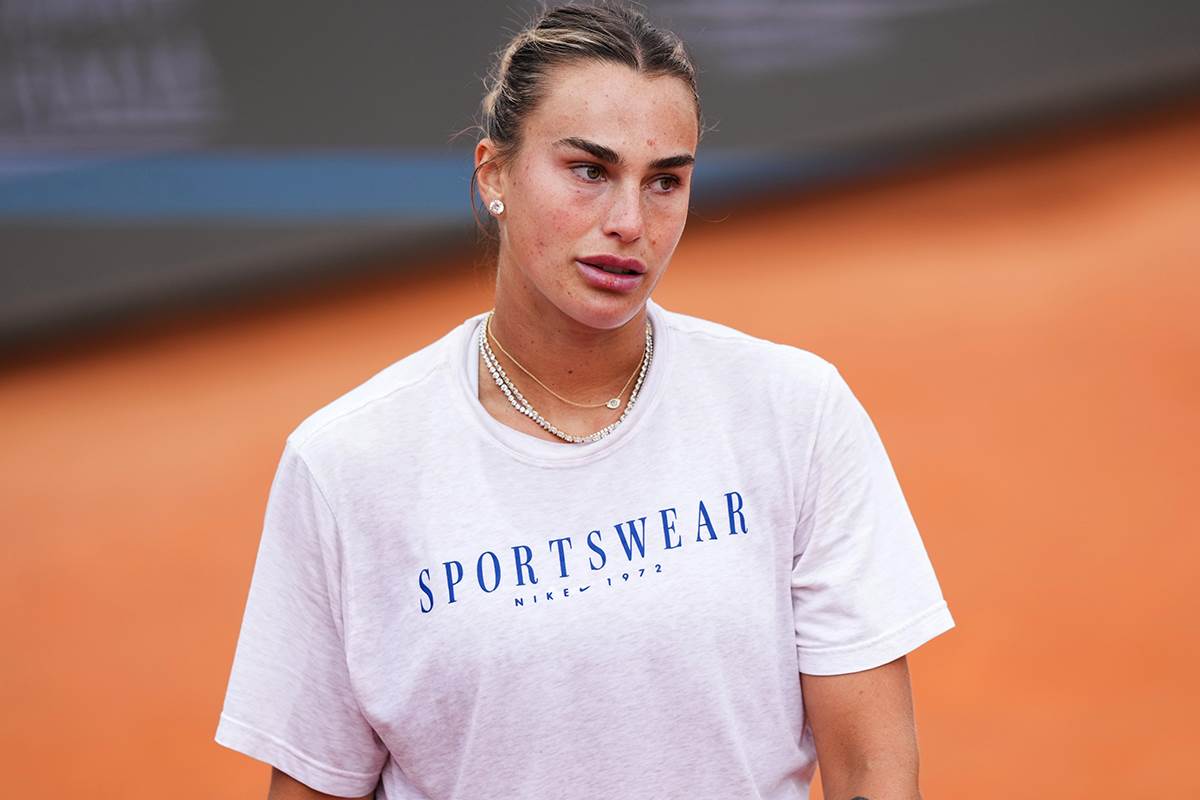  Arina Sabalenka na udaru kritika zbog napumpanih usana 