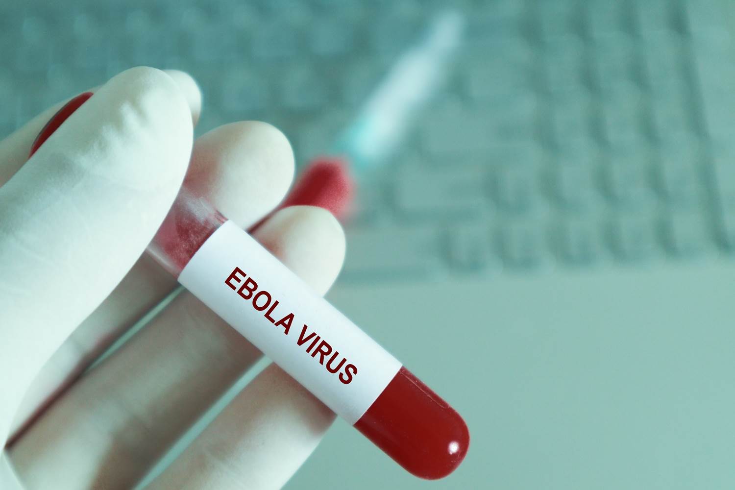  potvrđena epidemija ebola virusa u Kongu 