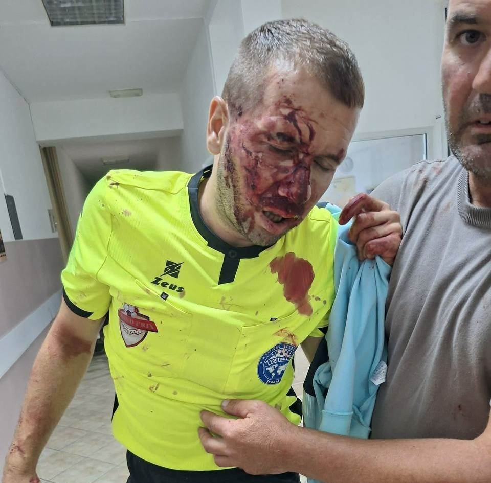  fk radnik osudio napad na sudiju Bojan Makarić 