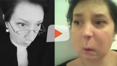  Da li je i vama "proradila štitna"? 