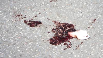  Tragedija šampiona: Geju ubili kćerku! 