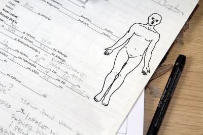  Udruženje patologa: Ne preporučuju se obdukcije umrlih od korona virusa 