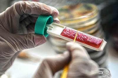  Institut za onkologiju i radiologiju Srbije zabranio posjete 