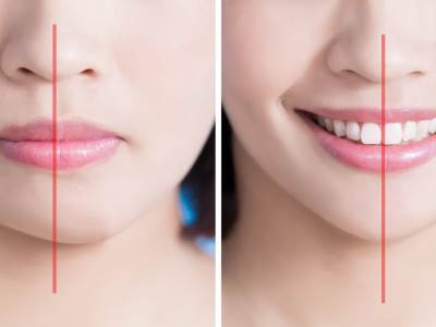  Šta znači ako imate asimetrične crte lica? Odgovor će vas obradovati 