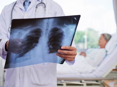  Upala pluća često nema simptome, evo na šta treba da obratite pažnju 