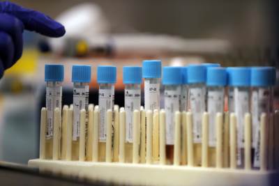 Rusi imaju nove testove na korona virus, više od 94% precizni 