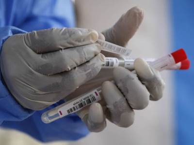  Koronavirus evidentiran u 37 gradova i opština Srpske 