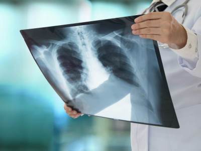  Najnoviji podaci: U Srbiji još tri smrtna slučaja i 58 novoobolelih 