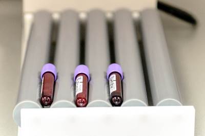 Serološko ispitivanje potvrdilo da oko 20 odsto testiranih u RS ima antitijela 