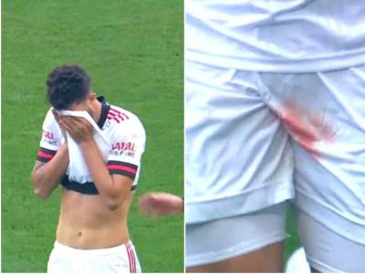  Brazil fudbal povreda Korintijans Flamengo 