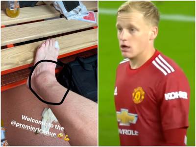  Doni Van de Bek - povreda zgloba odbrana Premijer liga 