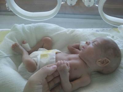  Mrvice prijevremeno rođene bebe u RS banka humanog mlijeka 