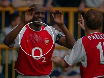  Patrik Vijera fleeka dres Arsenala mast koja pomaže disanje 