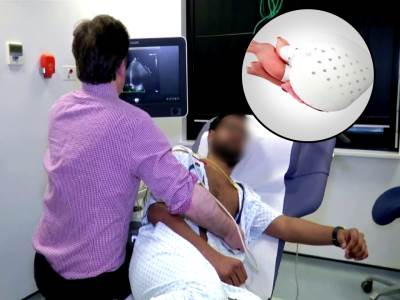  Vještačko srce uskoro u prodaji, radiće na baterije: EU dala zeleno svjetlo, poznata i cijena! (VIDEO) 