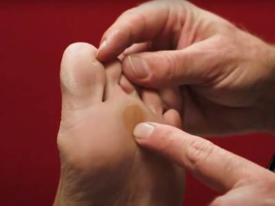 Simptomi raznih bolesti "kriju" se na stopalima: Prepoznajte problem sa srcem, jetrom, bubrezima ili štitastom žlezdom 