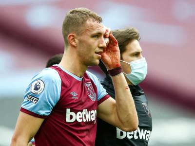  Vest Hem Totenhem Tomaš Souček krvava faca 