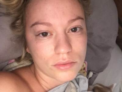  Podočnjaci i siva koža simptomi bolesti 