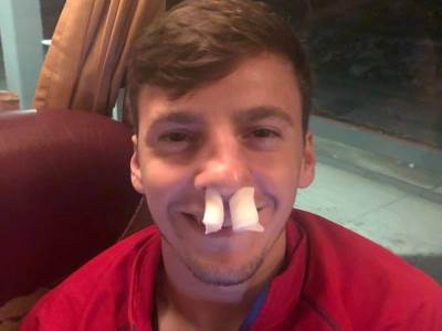  savo slavuljica za mondo: Dobro sam, nema preloma 