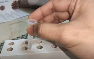  Korona u Srpskoj: Jedna žena zaražena, nema smrtnih slučajeva 