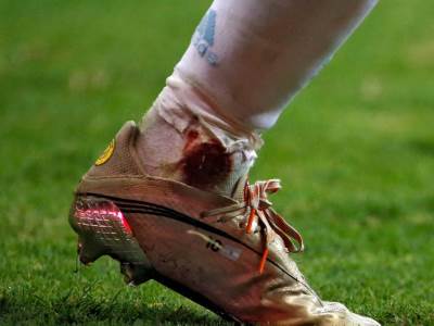  lionel mesi krvave noge argentina kopa amerika 