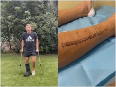  juventus artur melo povreda  