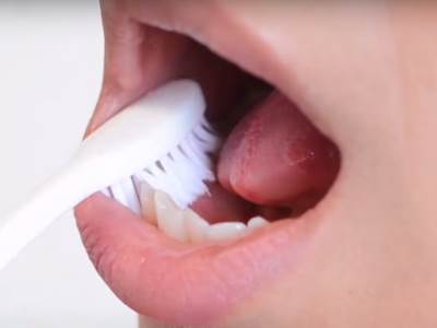  koliko često treba mijenjati četkicu za zube 