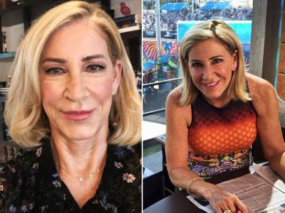  Bivsa-teniserka-Kris-Evert-boluje-od-raka 