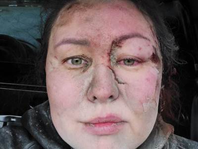  instruktorka plivanja o ratu u ukrajini 