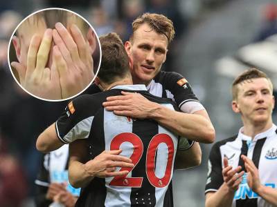  Den Burnu nedostaje jedan prst 