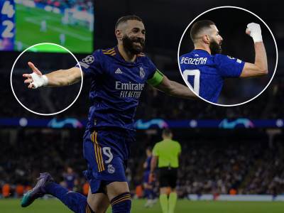  Zasto-Benzema-nosi-zavoj-na-ruci 