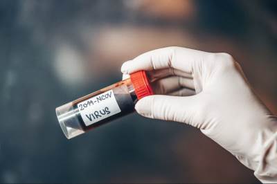  Epidemiološka situacija u FBiH 