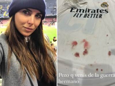  Igrač Reala donio dres natopljen krvlju 