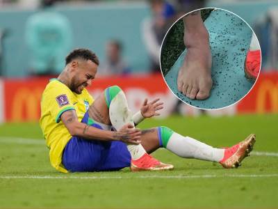  Povreda Nejmara na utakmici sa Srbijom 