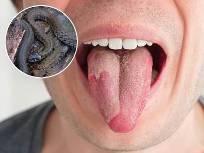  Čovjeka iz Indije ujela zmija za jezik 