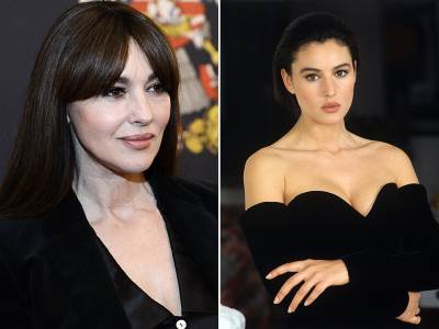  Estetske hirurgije Monike Beluči 