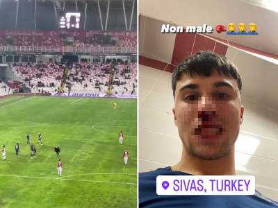  Navijač razbio nos fudbaleru Fiorentine 