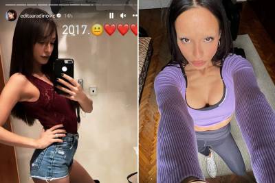  Edita Aradinović plastične operacije 