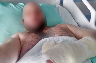  Ranjen radnik obezbjeđenja na fristaljleru 
