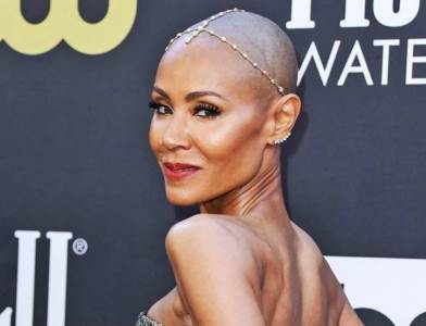  Džejda Smit o alopeciji 