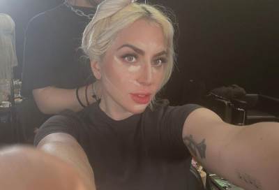  Lejdi Gaga plastične operacije 