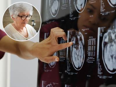  Naučnici ispitali mozak najstarijih ljudi 