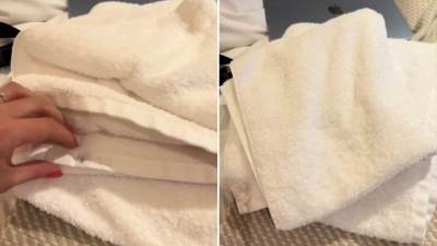  Žena pronašla čipove na peškirima u hotelu 
