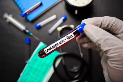  Od leptospiroze u Kantonu Sarajevo oboljele 64 osobe 