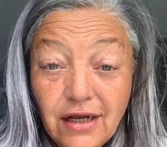  Žena (55) Prestala da puši, uštedjela 12.000 evra i otišla na operaciju lica: Rezultati su nevjerovatni 